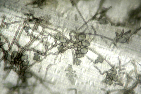 立枯病（ゾイシアデクライン）（菌足と菌糸②）